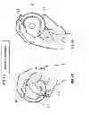 Fig. 16 - BASEBALL PITCHING TRAINING DEVICE