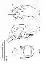 Fig. 17 - BASEBALL PITCHING TRAINING DEVICE