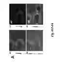 Fig. 09 - USE OF PERIOSTIN AS A NOVEL BIOMARKER