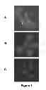 Fig. 02 - Method for the cytological analysis of cervical cells
