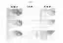 Fig. 07 - Use of Epothilone D in Treating Tau-Associated Diseases Including Alzheimer's Disease