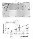 Fig. 08 - Use of Epothilone D in Treating Tau-Associated Diseases Including Alzheimer's Disease