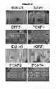 Fig. 22 - ENDOGENOUS RETROVIRUS POLYPEPTIDES LINKED TO ONCOGENIC TRANSFORMATION