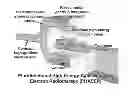 Fig. 01 - Pluridirectional very high electron energy radiation therapy systems and processes