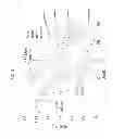 Fig. 09 - Pluridirectional very high electron energy radiation therapy systems and processes