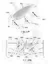 Fig. 31 - Controlling magnetic nanoparticles to increase vascular flow