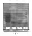 Fig. 53 - Controlling magnetic nanoparticles to increase vascular flow
