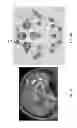 Fig. 05 - Enhanced Spatial Summation for Deep-Brain Transcranial Magnetic Stimulation