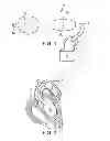 Fig. 02 - Dual-Balloon Cardiac Pump
