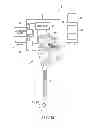 Fig. 12 - Insertion device with the operation input unit