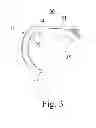 Fig. 04 - Intubation Tube