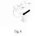 Fig. 07 - Intubation Tube