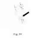 Fig. 11 - Intubation Tube