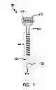 Fig. 02 - Trocar with retention cannula
