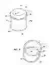 Fig. 02 - Hand access laparoscopic device
