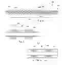 Fig. 06 - Systems and leads for improved RF compatibility and methods of manufacture and use