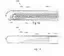 Fig. 09 - Systems and leads for improved RF compatibility and methods of manufacture and use