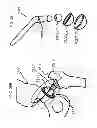 Fig. 33 - Medical device motion and orientation tracking system