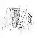 Fig. 34 - Medical device motion and orientation tracking system