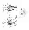 Fig. 35 - Medical device motion and orientation tracking system