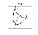 Fig. 06 - X-ray diagnosis apparatus and control method
