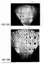 Fig. 09 - Method and apparatus to produce ultrasonic images using multiple apertures