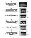 Fig. 04 - Methods, systems, and media for determining carotid intima-media thickness