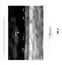 Fig. 07 - Methods, systems, and media for determining carotid intima-media thickness
