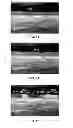 Fig. 09 - Methods, systems, and media for determining carotid intima-media thickness