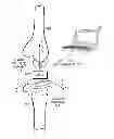 Fig. 01 - Prosthetic component having a compliant surface