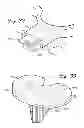Fig. 20 - Prosthetic component having a compliant surface