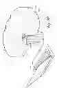Fig. 23 - Prosthetic component having a compliant surface