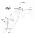 Fig. 01 - Method and system for aligning a prosthesis during surgery using active sensors