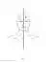 Fig. 07 - Therapeutic Method of Indirectly Relieving Localized Pain