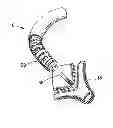 Fig. 01 - Steerable assembly for surgical catheter