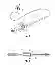Fig. 02 - Steerable assembly for surgical catheter