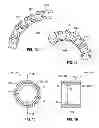 Fig. 07 - Steerable assembly for surgical catheter