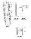 Fig. 08 - Steerable assembly for surgical catheter