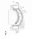Fig. 09 - Feeding set with cassette and related methods therefor
