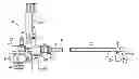 Fig. 01 - Methods for injecting a drug into prostate tissue