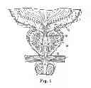 Fig. 02 - Methods for injecting a drug into prostate tissue