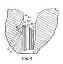 Fig. 06 - Methods for injecting a drug into prostate tissue