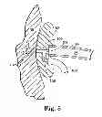 Fig. 08 - Methods for injecting a drug into prostate tissue