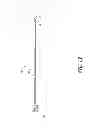 Fig. 02 - Detachable tip microcatheter