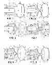 Fig. 02 - Cavitation reduction in catheter removal