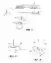 Fig. 02 - SYSTEM AND METHOD FOR INCISING A TILTED CRYSTALLINE LENS