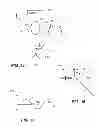Fig. 05 - SYSTEM AND METHOD FOR INCISING A TILTED CRYSTALLINE LENS