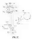 Fig. 06 - SYSTEM AND METHOD FOR INCISING A TILTED CRYSTALLINE LENS