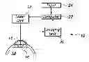 Fig. 01 - System and Method for Configuring Fragmentation Segments of a Crystalline Lens for a Lensectomy