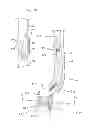 Fig. 04 - Skull clamp opening apparatus and method